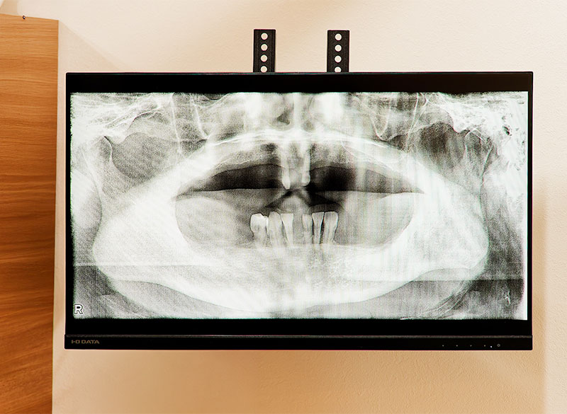 説明用モニター