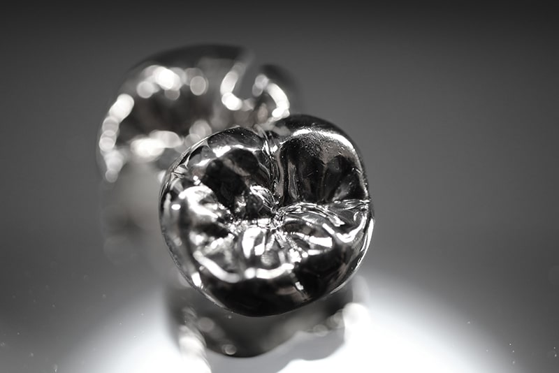 銀歯（金銀パラジウム合金）などの詰め物・被せ物