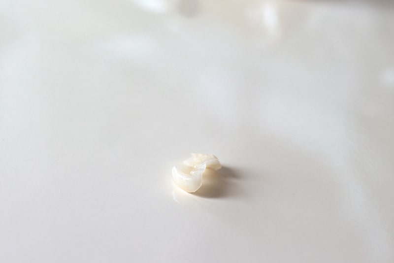 セラミック（陶材修復）