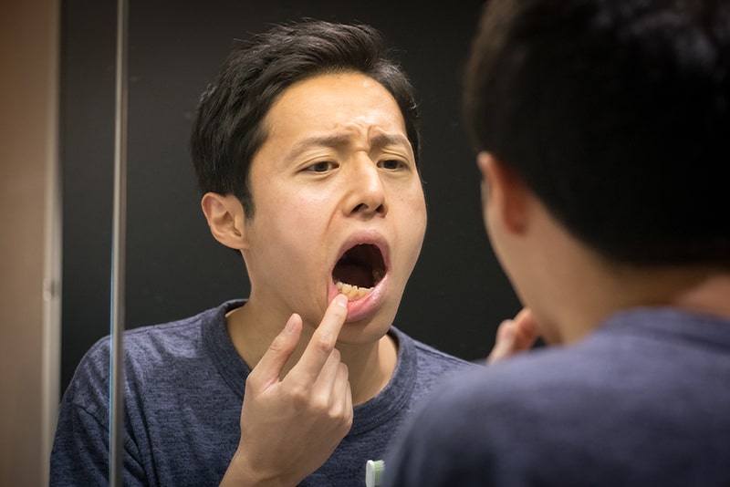 インプラントで噛む力と見た目を取り戻しましょう