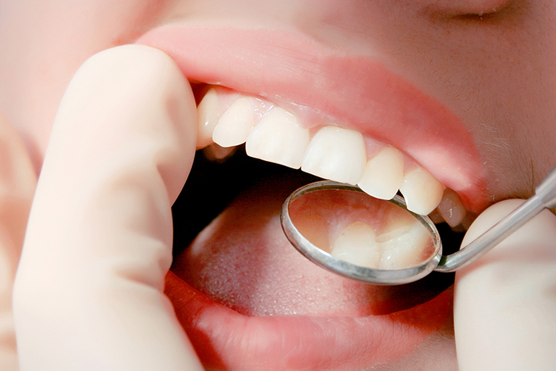 口腔環境の整備