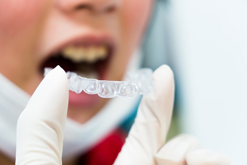 歯周病による全身への影響