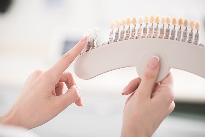 ホワイトニングの注意事項