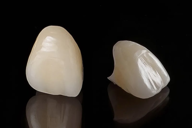 床矯正（拡大床）